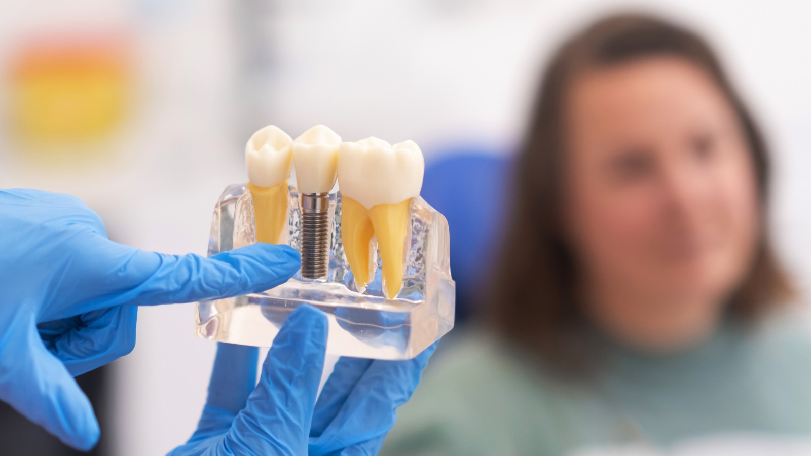 Exploring the Artistic Craft of Dental Restoration